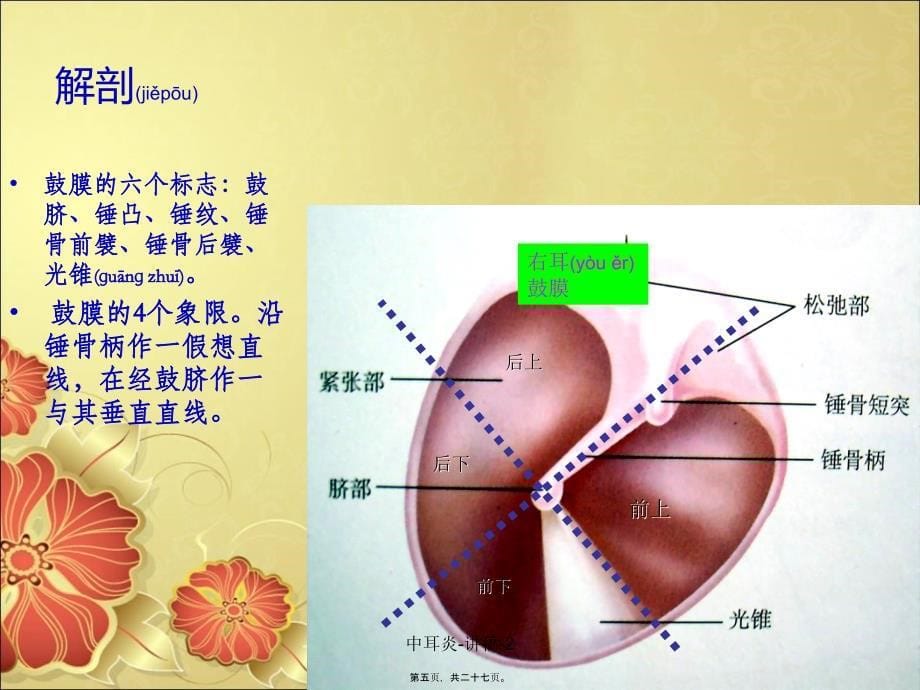 中耳炎-讲稿-2课件_第5页