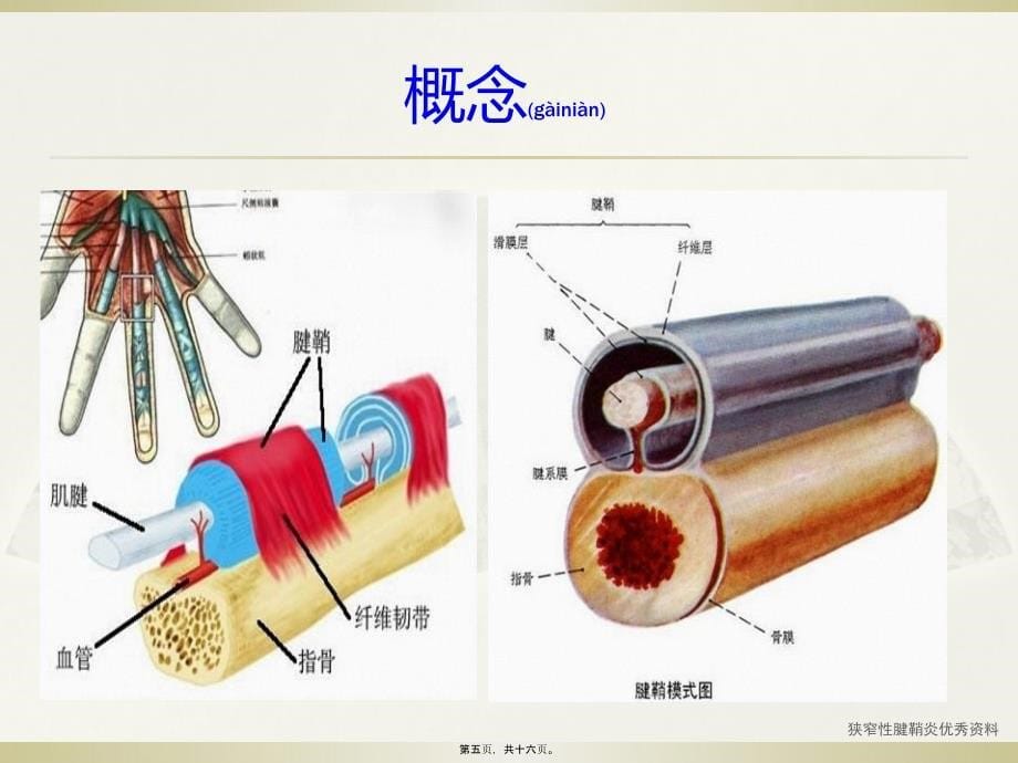 狭窄性腱鞘炎优秀资料课件_第5页