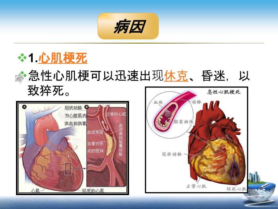 突发性猝死的应急预案及流程课件_第3页