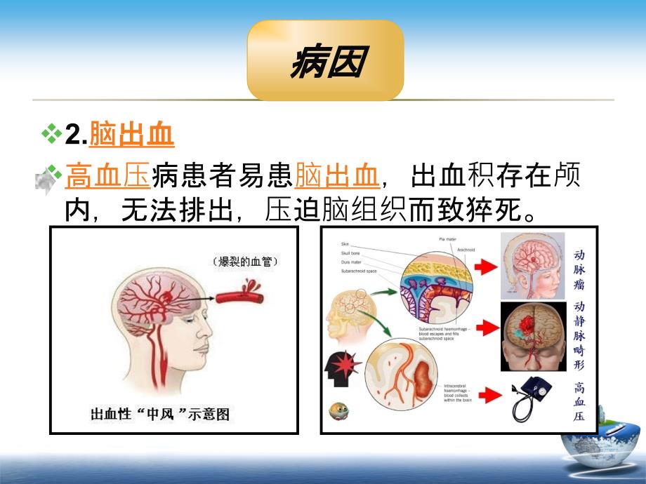 突发性猝死的应急预案及流程课件_第4页