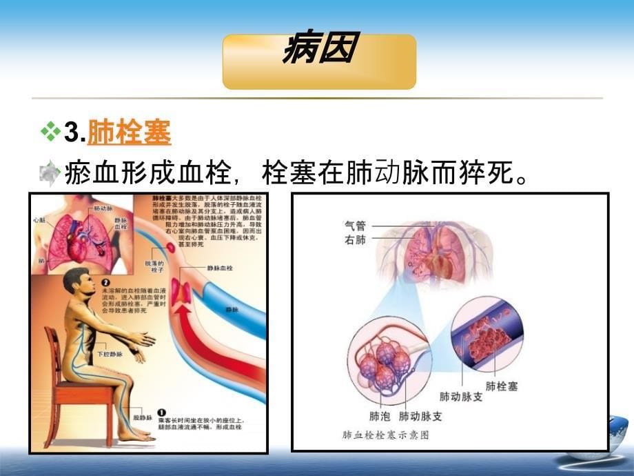 突发性猝死的应急预案及流程课件_第5页