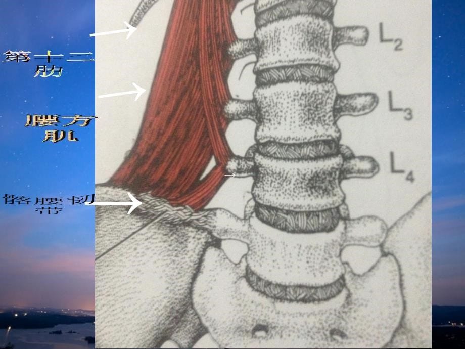 腰方肌pt课件_第5页