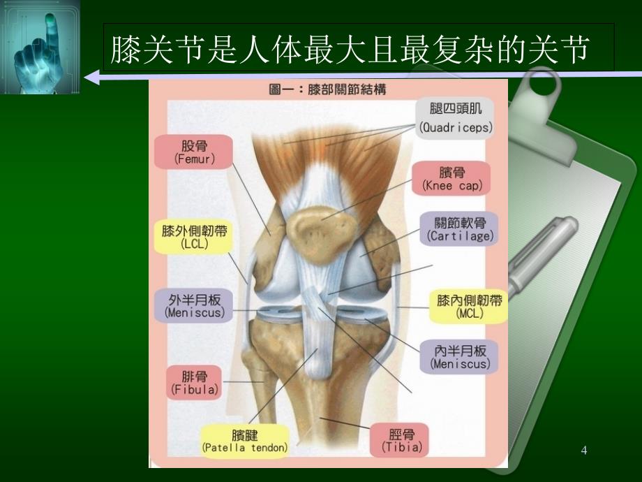 膝关节疼痛的诊断与治疗优秀课件_第4页