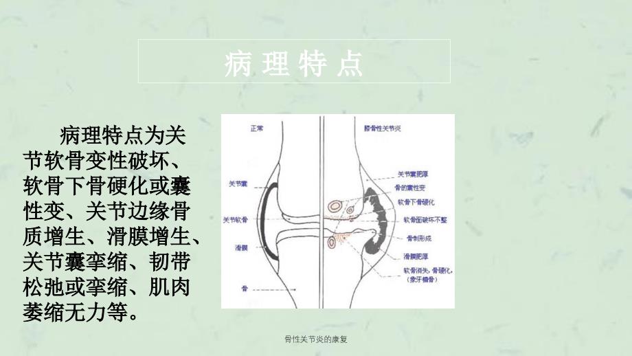 骨性关节炎的康复课件_第3页