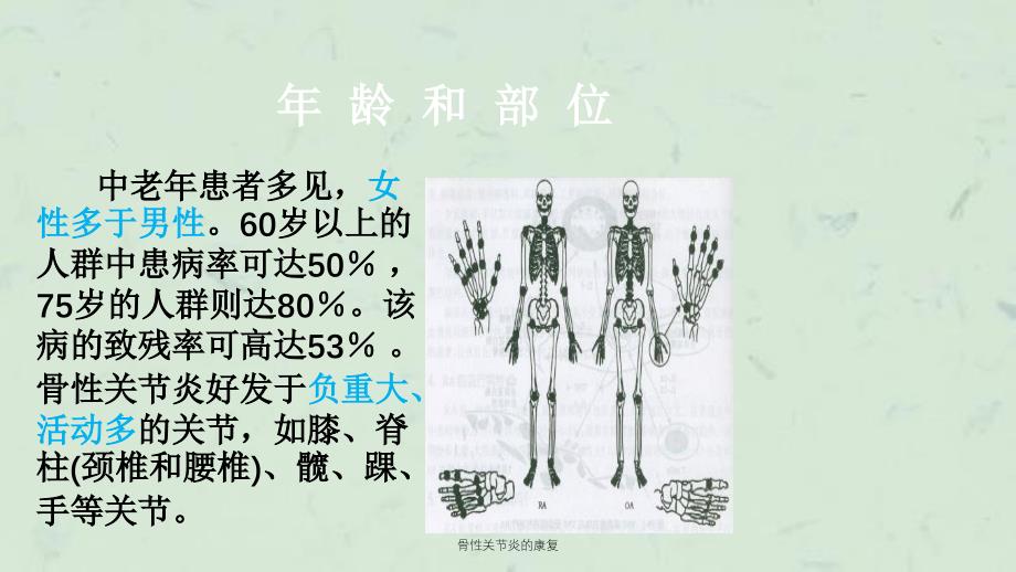 骨性关节炎的康复课件_第4页