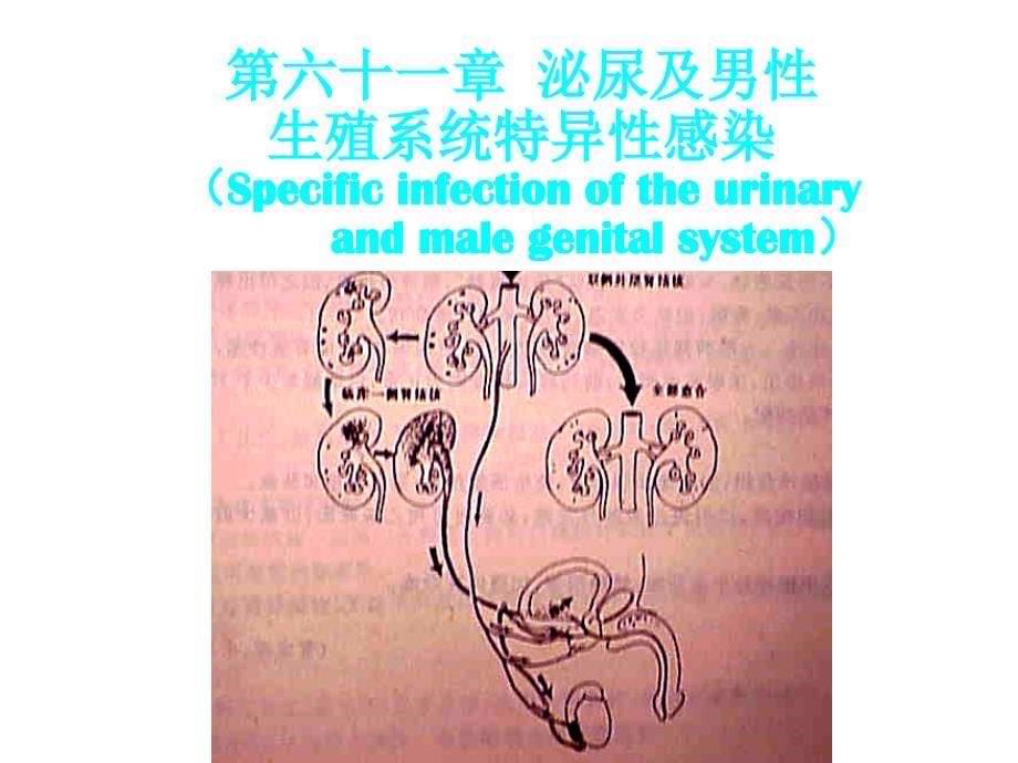 泌尿及男性生殖系感染_第5页