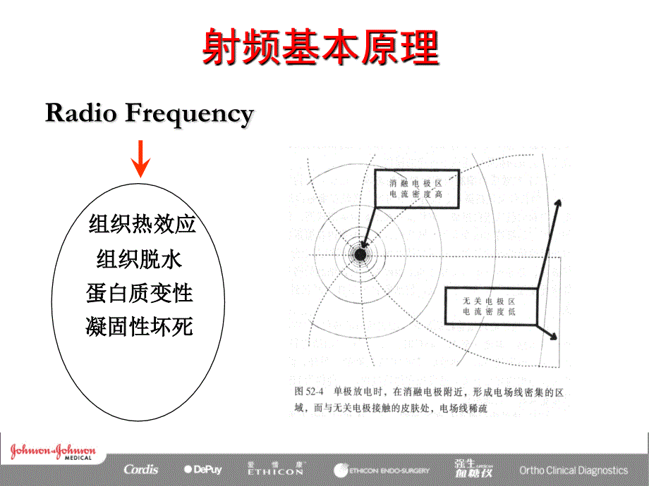 射频消融原理_第4页