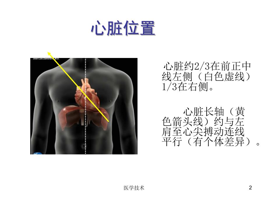 超声心动图常用切面的打法图解医学技术_第2页