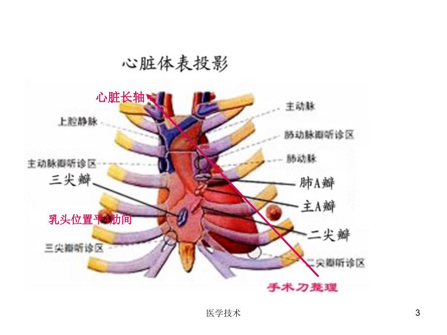 超声心动图常用切面的打法图解医学技术_第3页