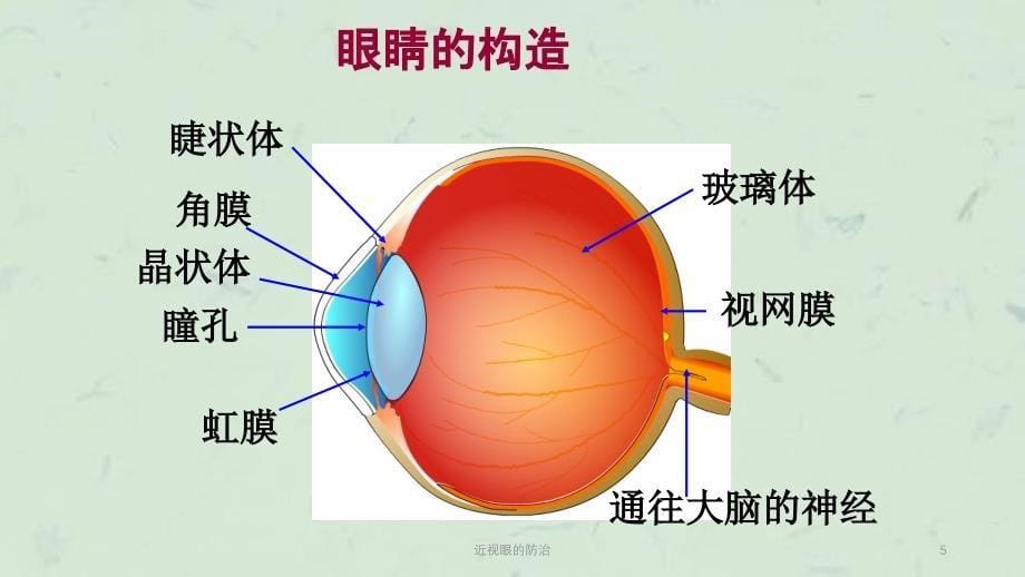 近视眼的防治课件_第5页