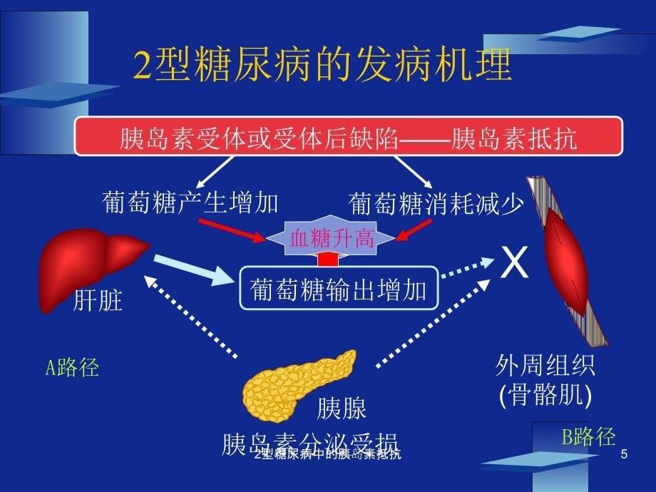 2型糖尿病中的胰岛素抵抗课件_第5页