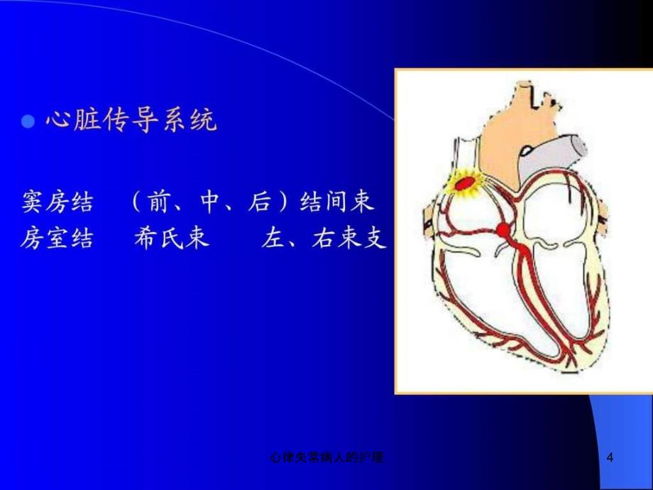 心律失常病人的护理课件_第4页