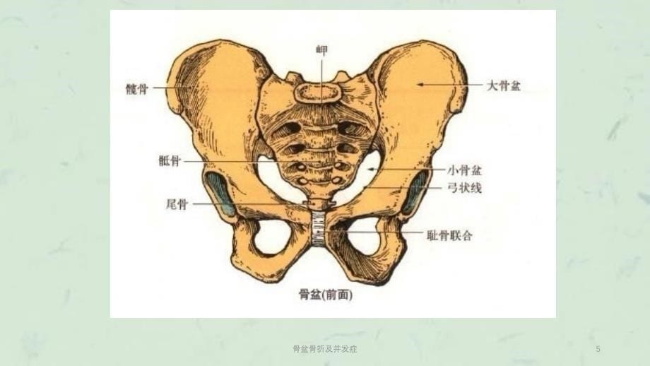 骨盆骨折及并发症课件_第5页