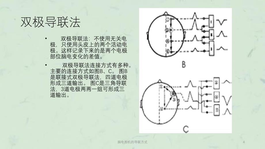 脑电图机的导联方式课件_第4页