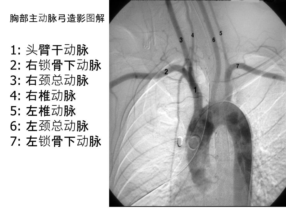 胸部X线图解胸部后前位平片图解文档资料_第2页