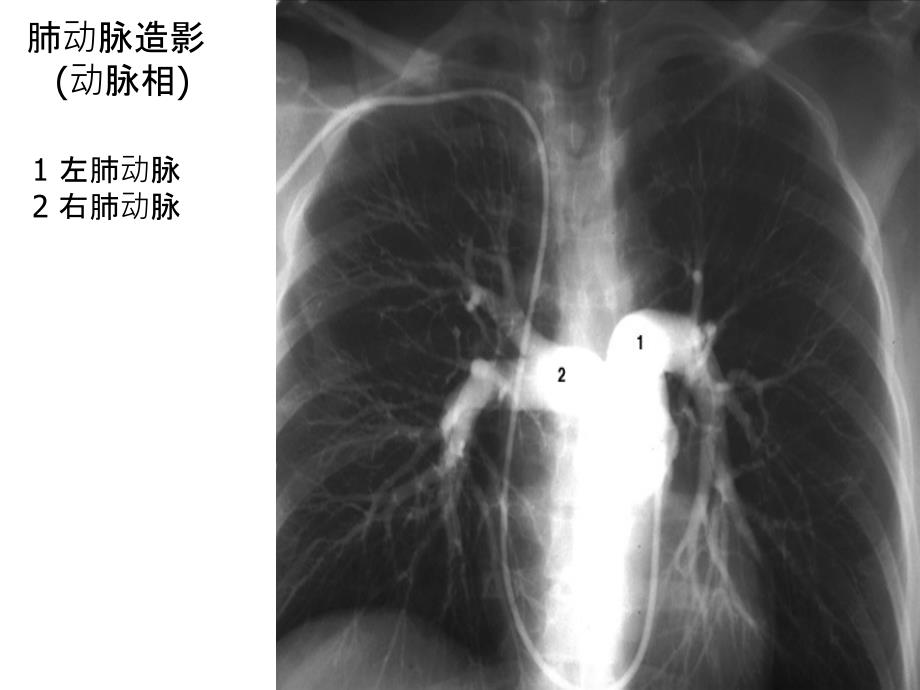 胸部X线图解胸部后前位平片图解文档资料_第3页