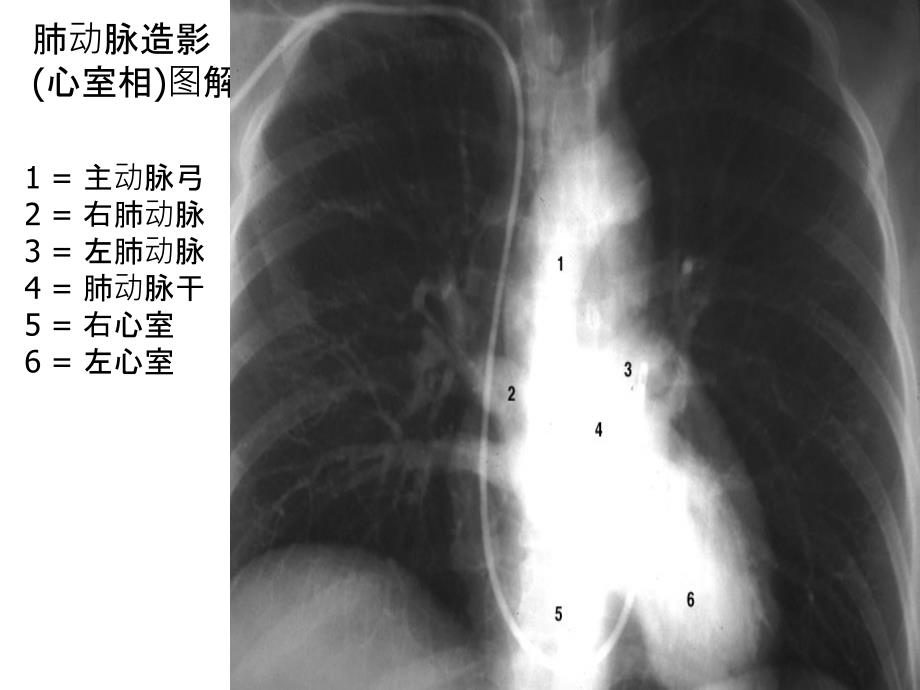 胸部X线图解胸部后前位平片图解文档资料_第4页