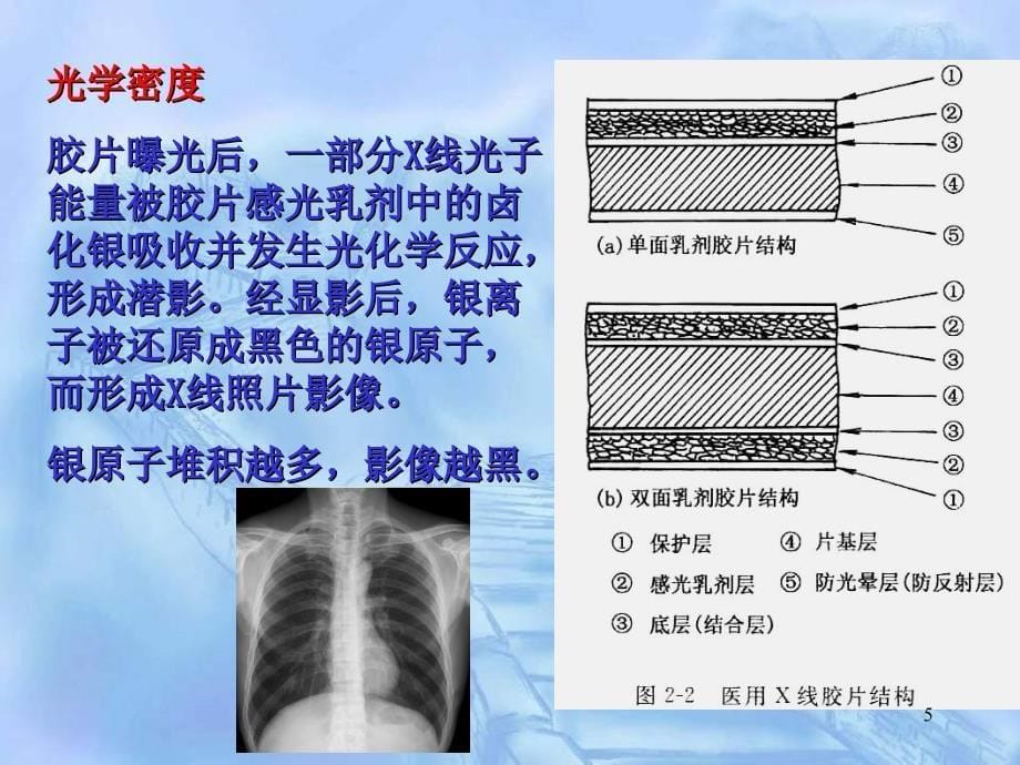 2X线成像基本因素PowerPoint 演示文稿_第5页