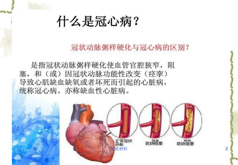 PCI术的护理查房参考材料_第2页