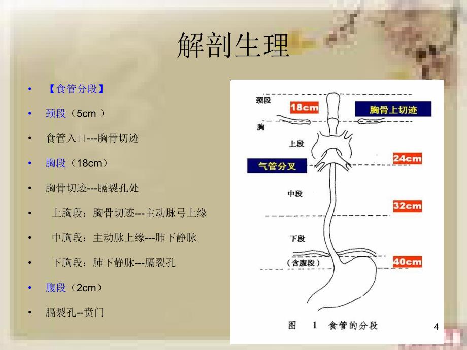 食管癌的教学查房ppt课件_第4页