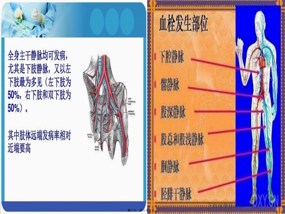 下肢深静脉血栓课件_第2页