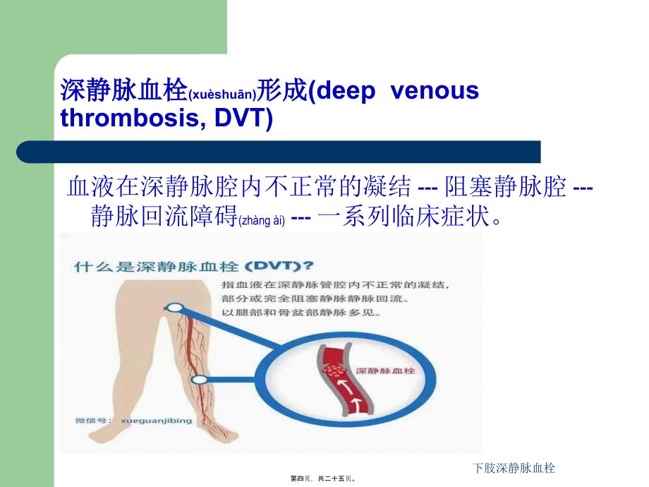 下肢深静脉血栓课件_第4页