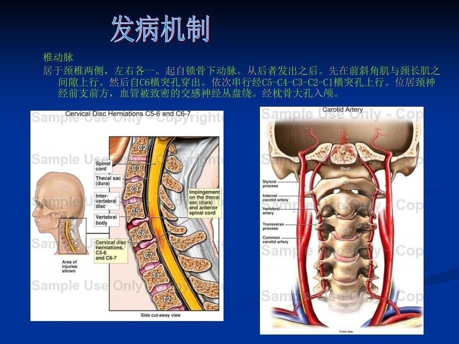 颈性眩晕的临床分析与对策邹季_第5页