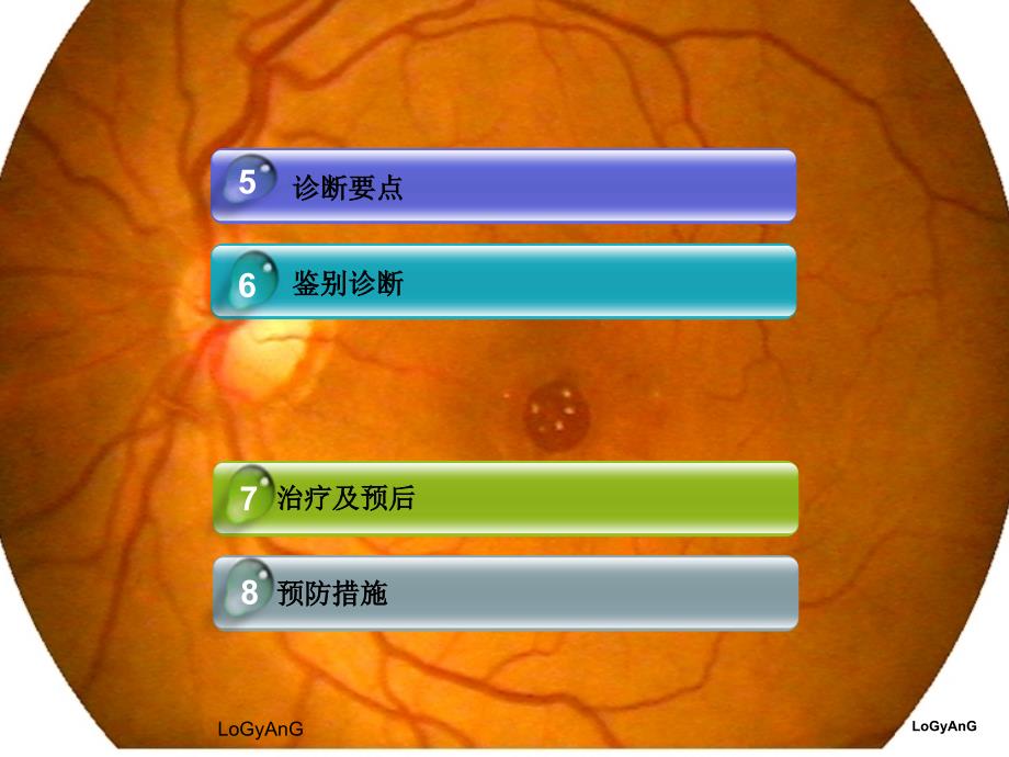 黄斑裂孔黄斑裂孔分期在OCT中的表现_第3页