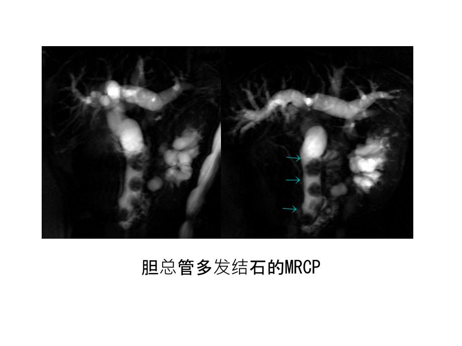 临床医学影像检查6_第2页