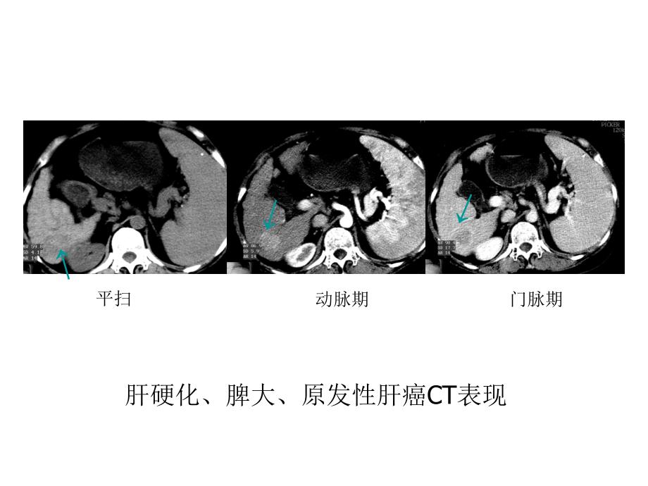 临床医学影像检查6_第3页