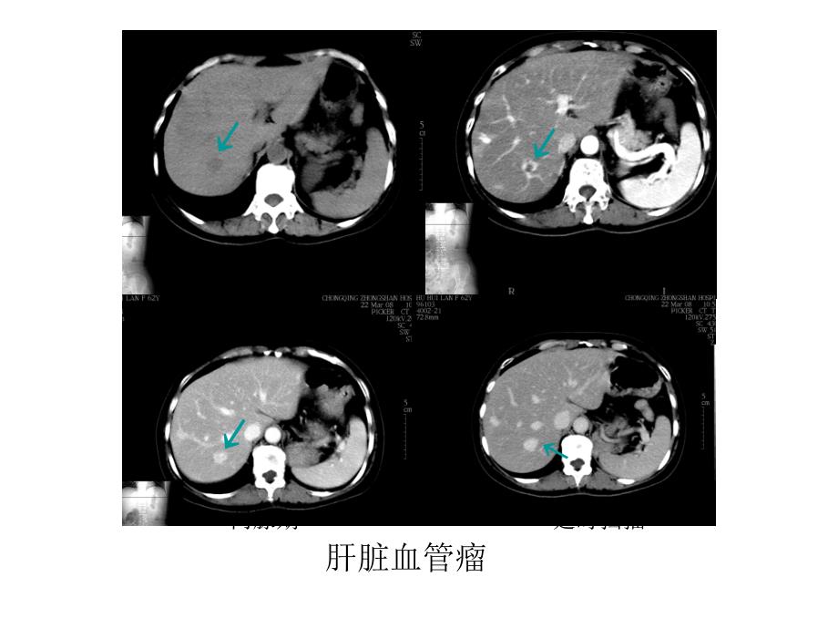 临床医学影像检查6_第4页