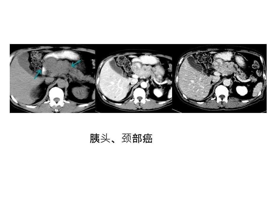 临床医学影像检查6_第5页