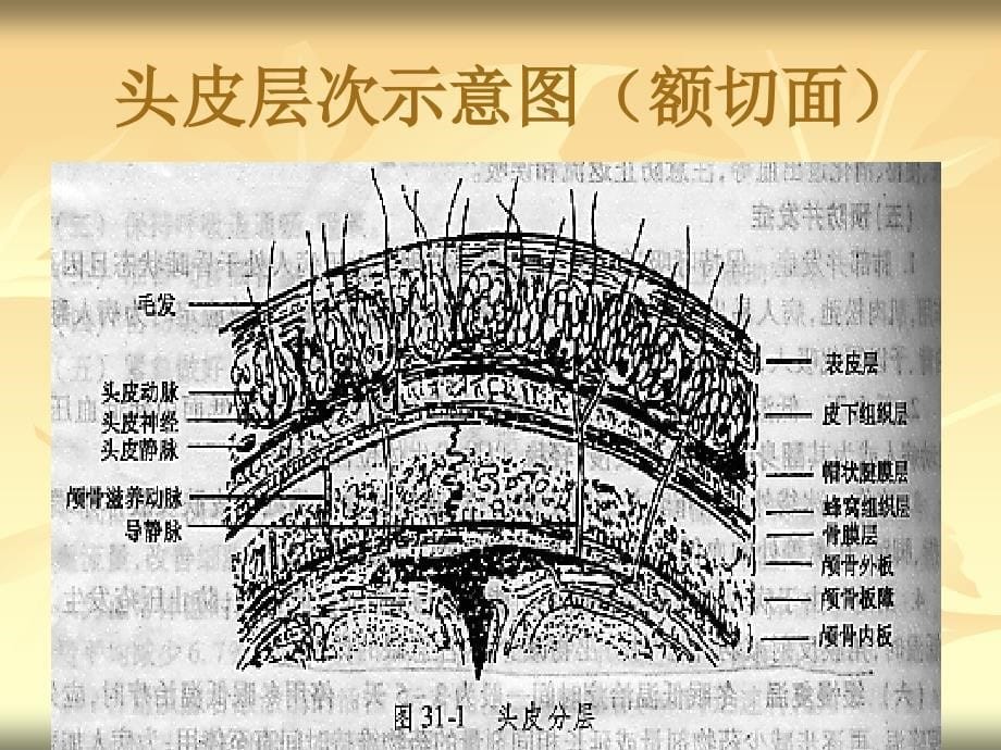 第24章颅脑损伤病人的护理_第5页