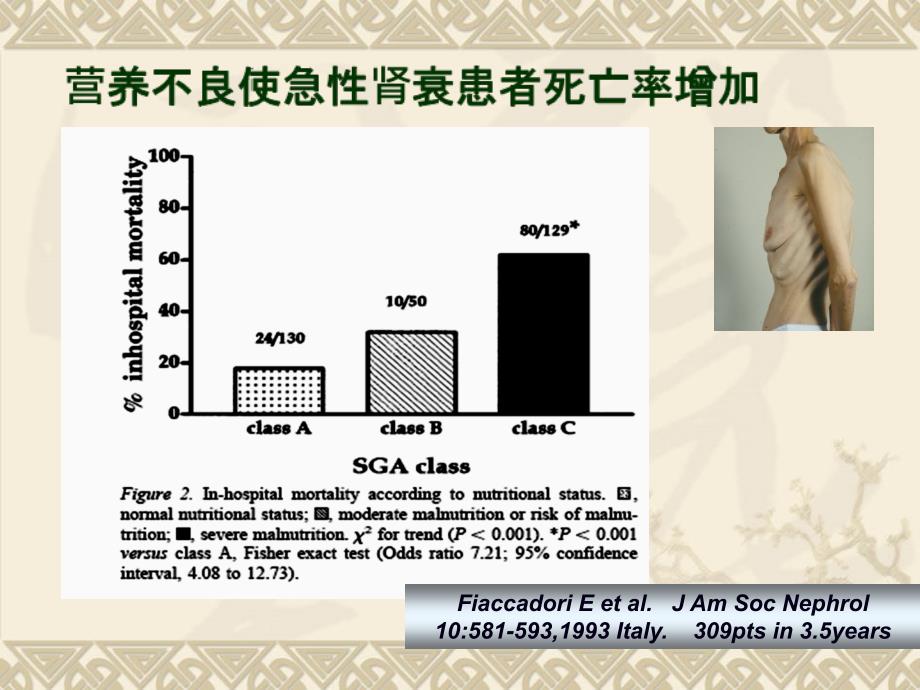 急性肾衰患者的营养课件_第4页