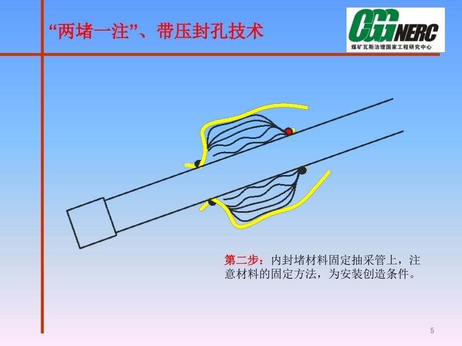 两堵一注、带压封孔技术_第5页