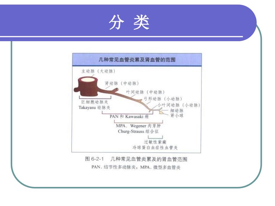 系统性血管炎肾脏损害_第4页