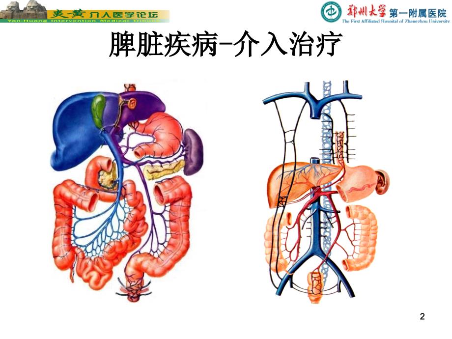 脾脏的介入栓塞治疗PPT参考幻灯片_第2页