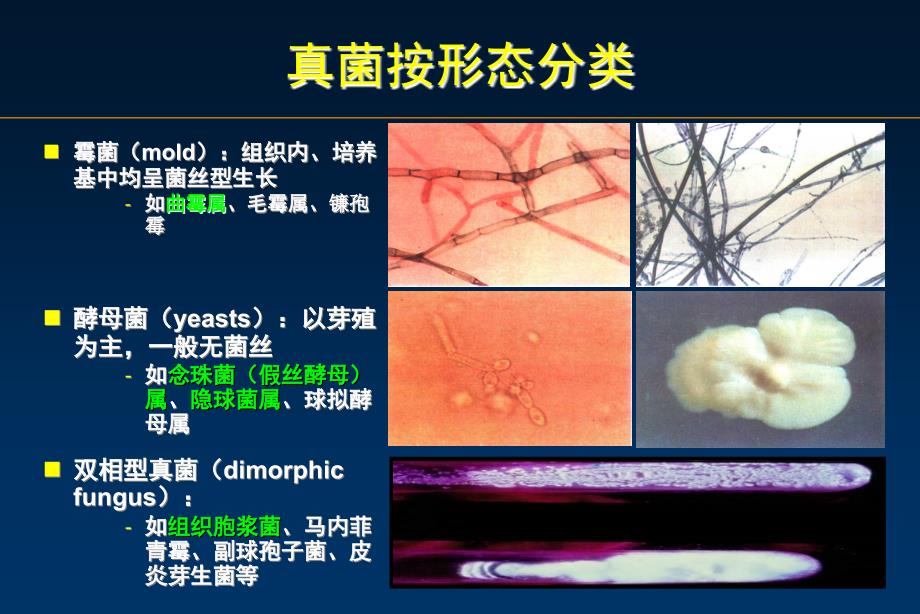 侵袭性肺曲霉病.ppt_第2页