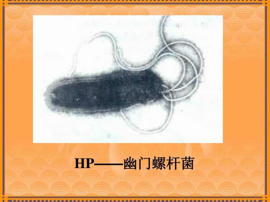 幽门螺旋杆新认识与治疗ppt课件_第4页