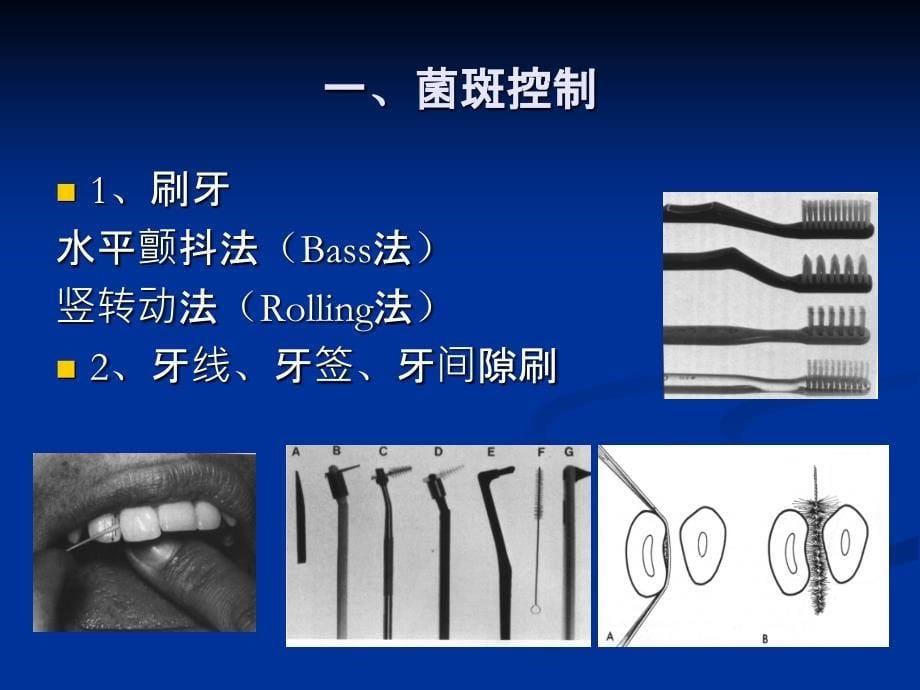 牙周病的治疗过程_第5页