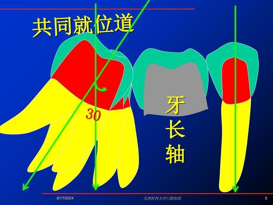 固定义齿的设计课件_第5页