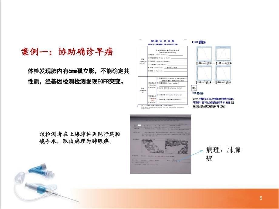 临床肿瘤基因检测简介PPT幻灯片课件_第5页