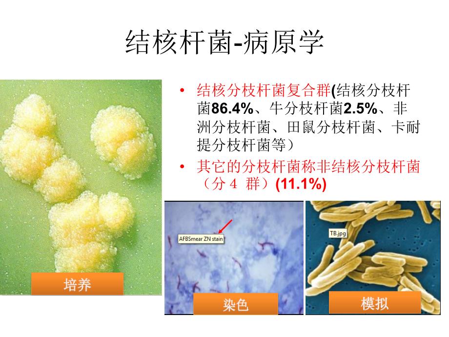 肺结核的医院感染控制.ppt_第4页