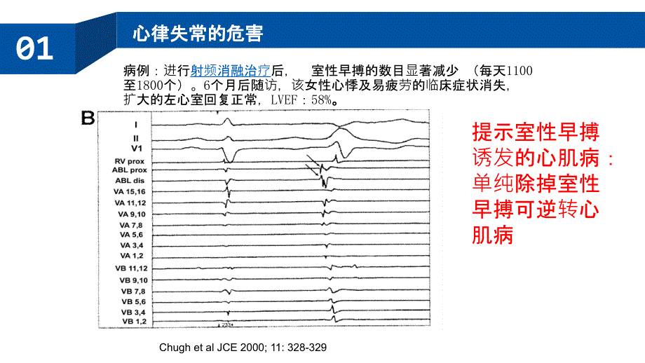 室性心律失常的射频消融治疗PPT课件_第4页