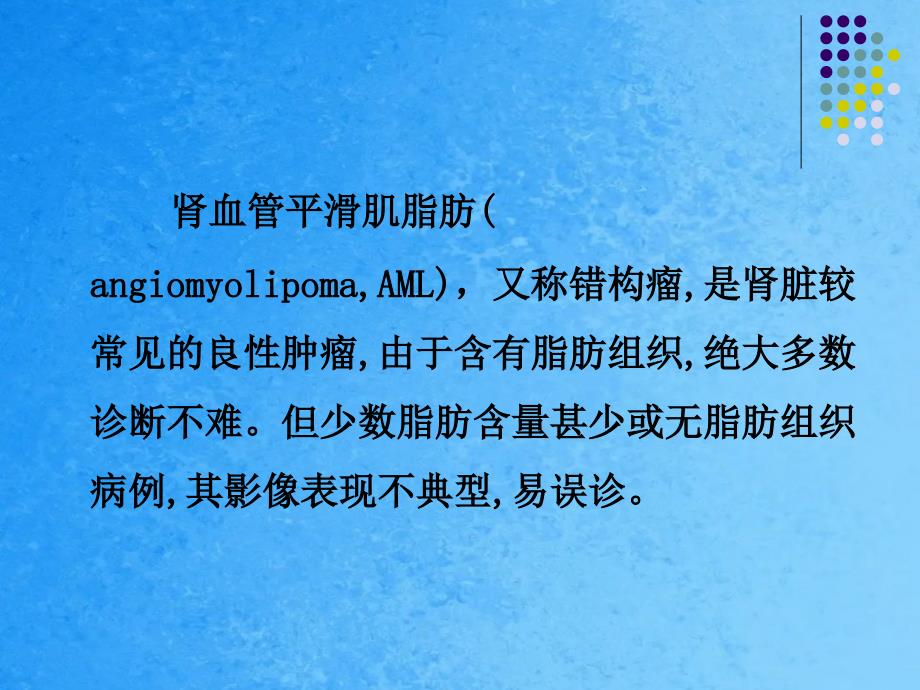 乏脂肪性肾血管平滑肌脂肪瘤的ct与mri表现.ppt课件_第3页