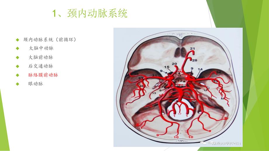 穿支动脉梗死_第4页