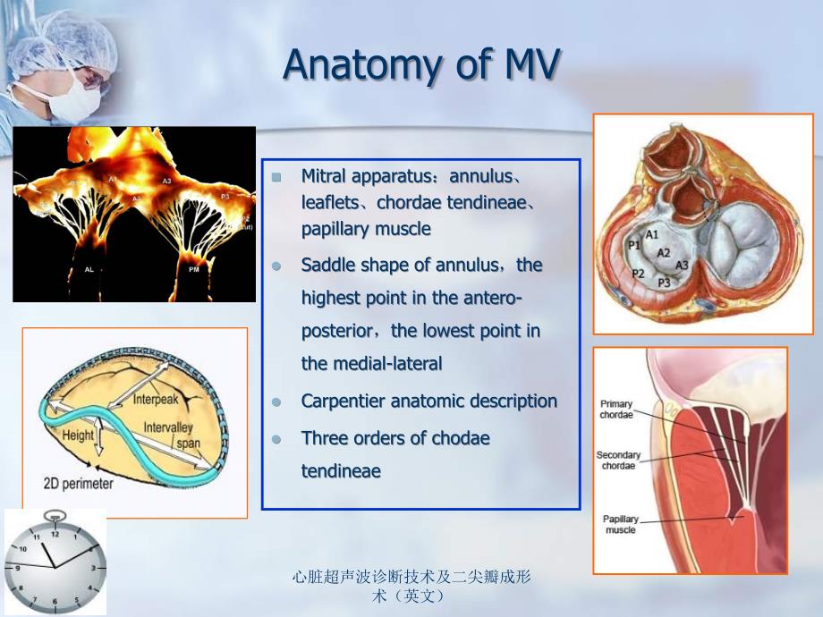 心脏超声波诊断技术及二尖瓣成形术英文课件_第2页