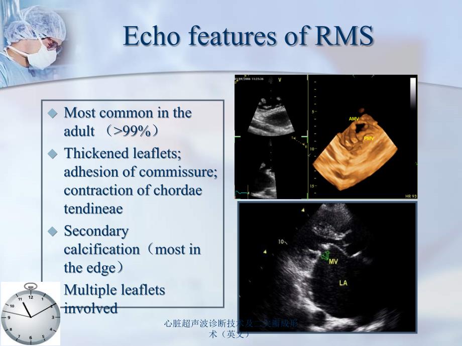 心脏超声波诊断技术及二尖瓣成形术英文课件_第3页