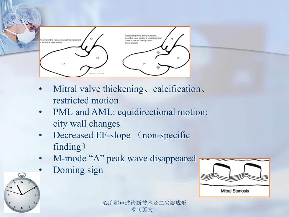 心脏超声波诊断技术及二尖瓣成形术英文课件_第4页