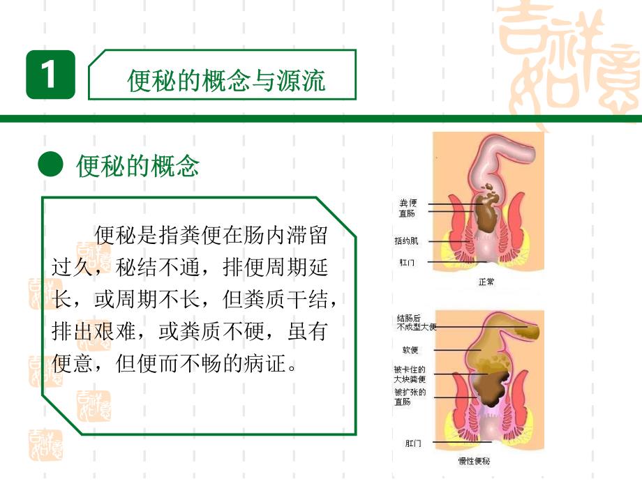 便秘的中医药辨证治疗.ppt_第4页